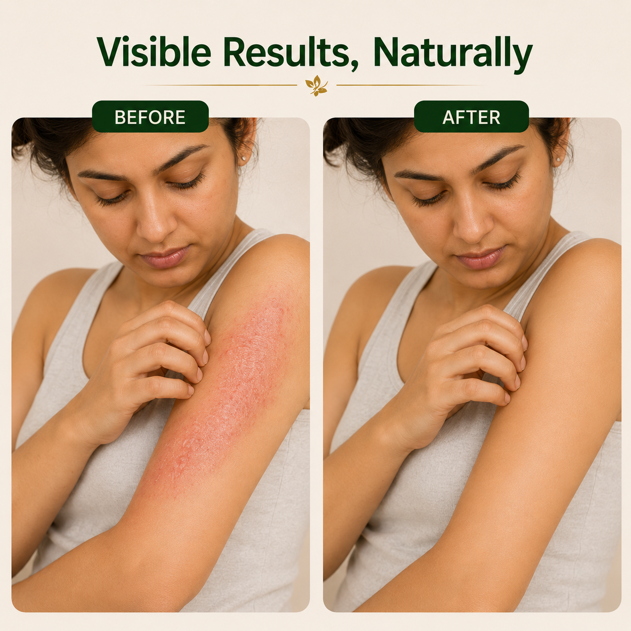 Charma Binash Ayurvedic Syrup | Herbal Skin Disease Support 450ml