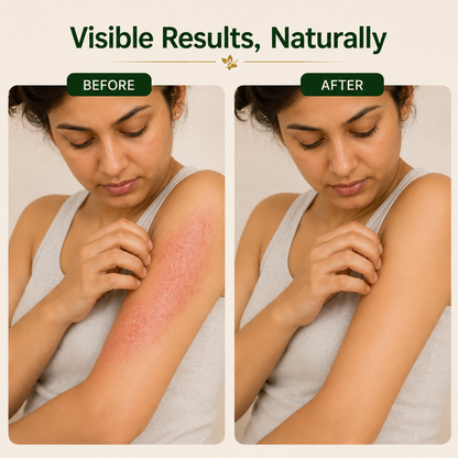 Charma Binash Ayurvedic Syrup | Herbal Skin Disease Support 450ml